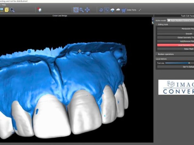 Why is Digital Planning Software Essential for Modern Dental Practices?